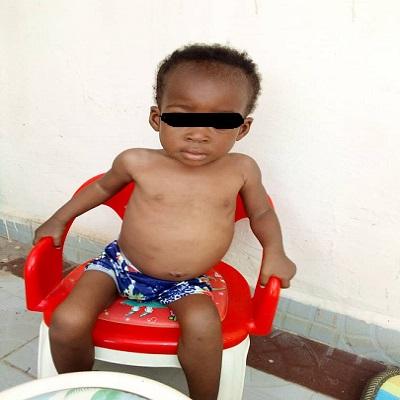 You are currently viewing 17-month-old baby needs N700, 000 for cancer treatment
