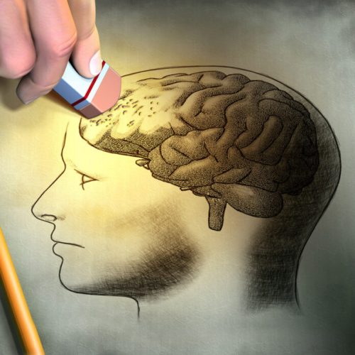 Man, 66, suffers amnesia after afternoon sex with wife