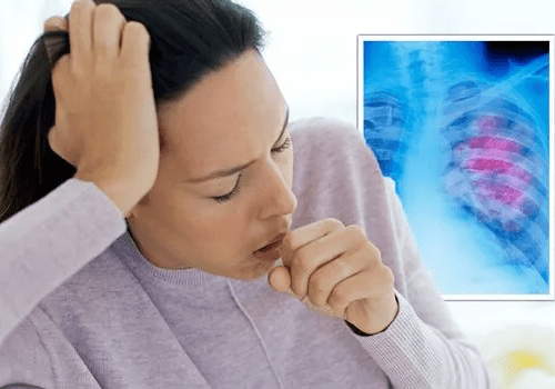 Read more about the article The signs in your cough that could be signalling lung cancer tumour – symptoms