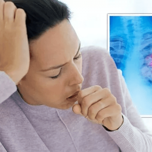 The signs in your cough that could be signalling lung cancer tumour – symptoms