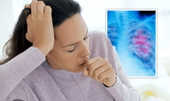 You are currently viewing The signs in your cough that could be signalling lung cancer tumour – symptoms