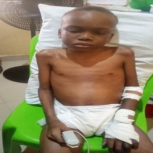 10-year-old stroke patient needs N7m for multiple surgeries