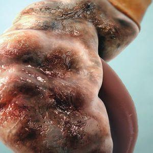 Kidney