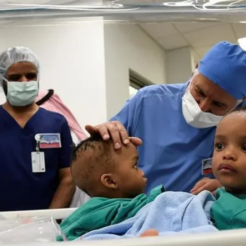 Conjoined Nigerian twins successfully separated in hours-long operation in Saudi