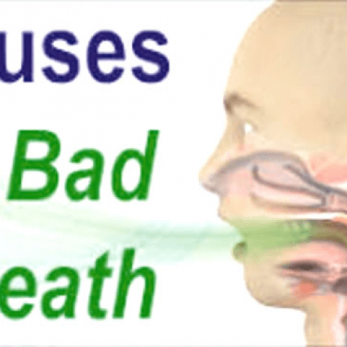 Habits that can cause halitosis (bad breath)