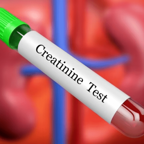 Five diet tips to reduce creatinine levels for healthy kidneys