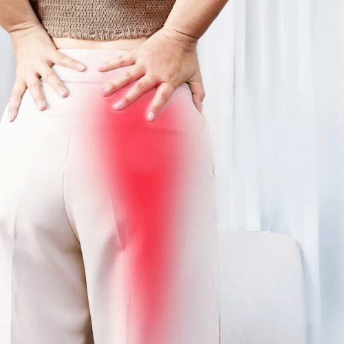 Read more about the article 10 natural herbs that relieve Sciatica pain