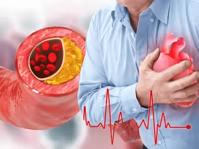 You are currently viewing Blocked Heart Arteries: Top 7 Home Remedies To Clean Clogged Heart Naturally Without Medication