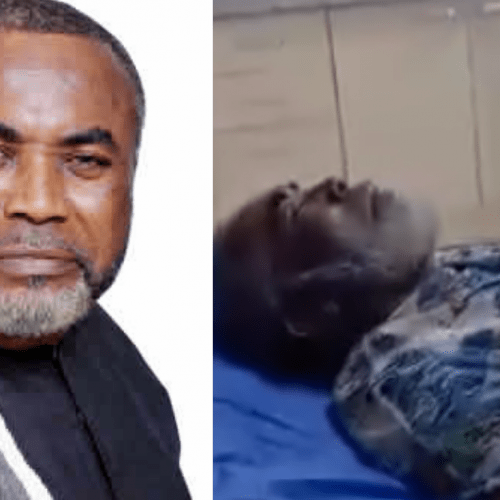Read more about the article How I slumped, underwent two surgeries in Nigeria –  Zack Orji