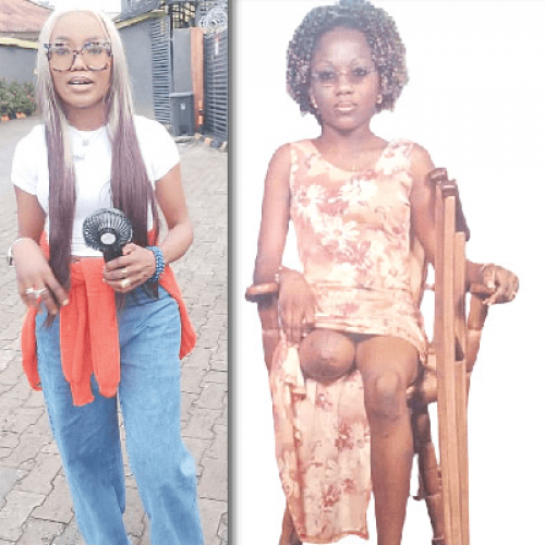 How I became an amputee two days after my birthday – Businesswoman