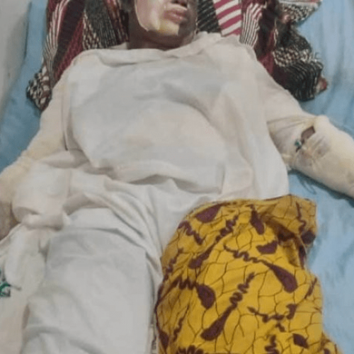 10 Students Suffer Severe Burns in Ebonyi School Gas Explosion