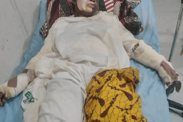 You are currently viewing 10 Students Suffer Severe Burns in Ebonyi School Gas Explosion