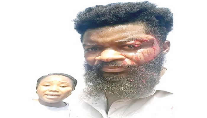 You are currently viewing General who assaulted me deleted video evidence, labelled me assassin – Abuja-based health worker