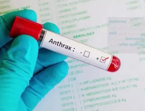 Read more about the article FG alerts Nigerians over outbreak of anthrax in Zamfara