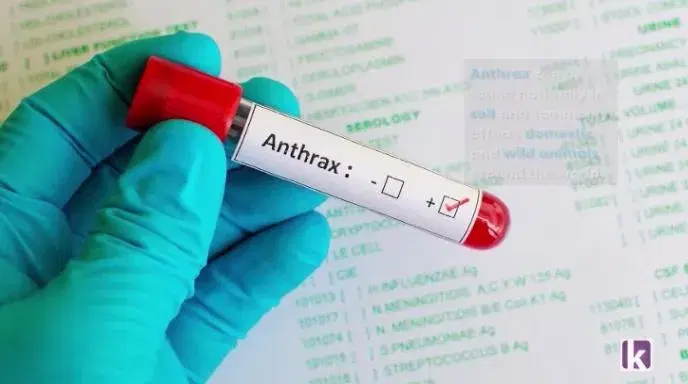 You are currently viewing FG alerts Nigerians over outbreak of anthrax in Zamfara