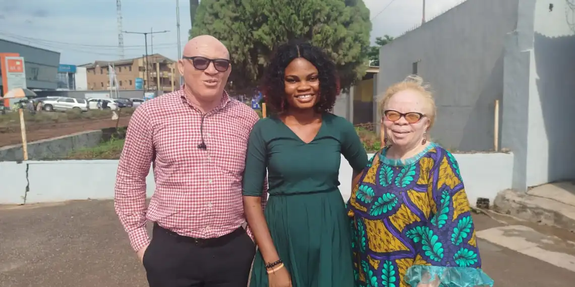 You are currently viewing Nigerians with albinism dying of skin cancer due to healthcare gaps
