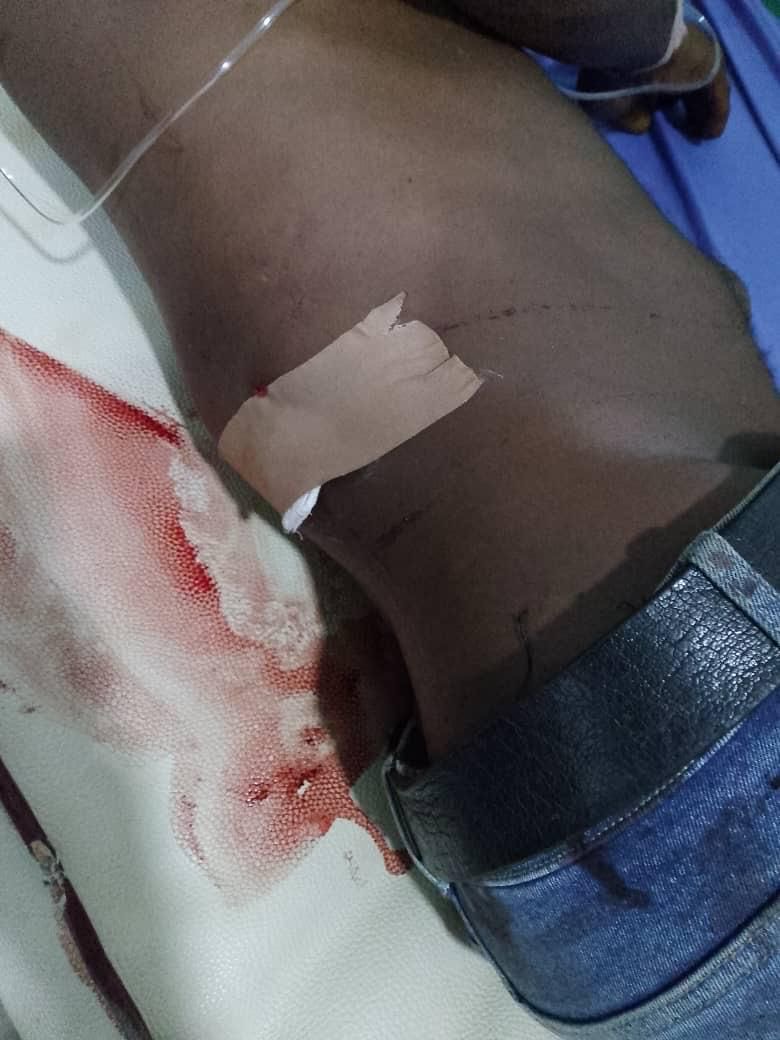 You are currently viewing Gunmen Open Fire On NDLEA Officers During Abuja Drug Raid – Three Hospitalized