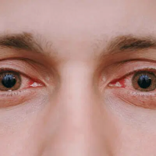 Why addicted mobile device users may suffer deplorable eye health