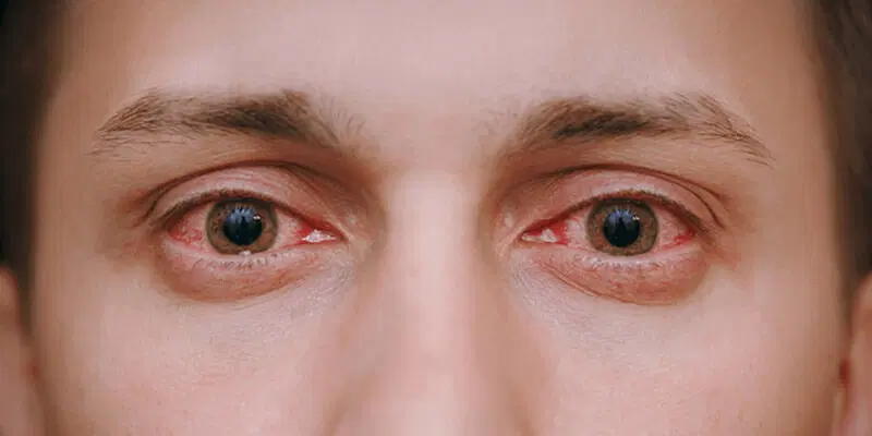 You are currently viewing Why addicted mobile device users may suffer deplorable eye health