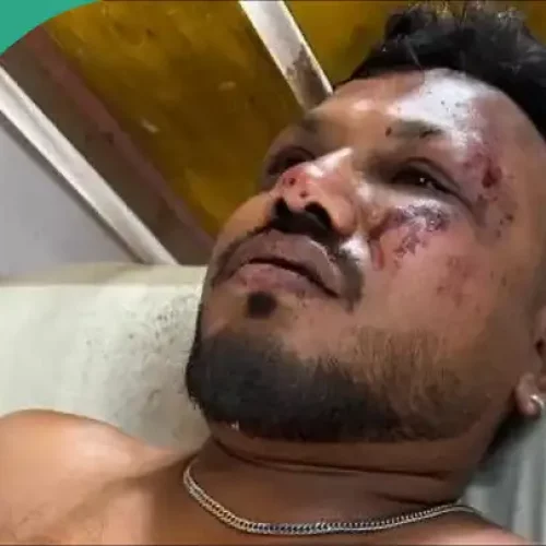 Vishwash Kumar Ramesh: Details, Photo of Man Who Survived India Crash That Claimed 241 Lives Emerge