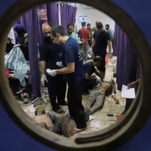 Gaza Doctors ‘Becoming Too Weak To Treat Patients’ As Hunger Crisis Deepens