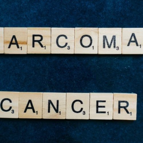 Sarcoma Cancer: Oncologist Reveals 6 Main Causes Of Cancer That Develops In Bones, Muscles And Blood Vessels