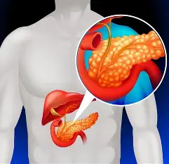 Read more about the article Researchers Find New Way to Detect Early Signs of Pancreatic Cancer