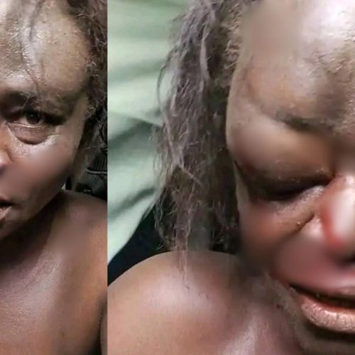 Read more about the article Police Confirm Death Of Suspected Female Kidnapper Mobbed In Kwara, Say Claim False