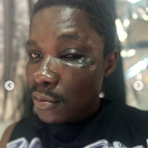 Read more about the article Lagos NURTW Boss Disowns Member Who Beat A Dispatch Rider To Death