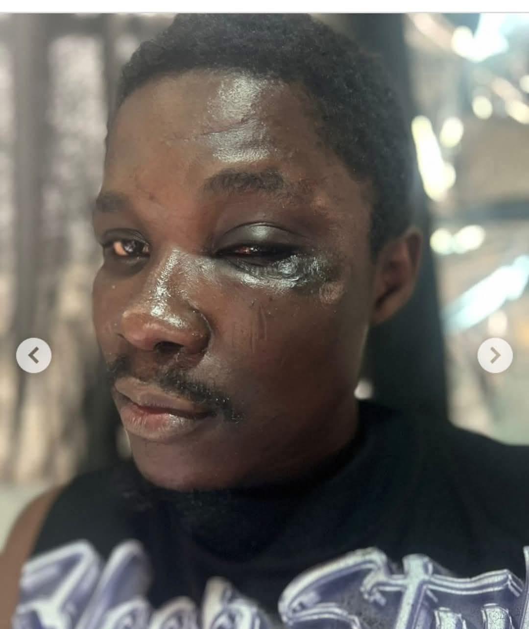 You are currently viewing Lagos NURTW Boss Disowns Member Who Beat A Dispatch Rider To Death