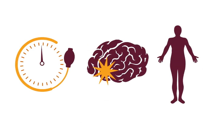 Here’s How to Spot the First Signs of a Stroke 1 DEY4CIxO 720